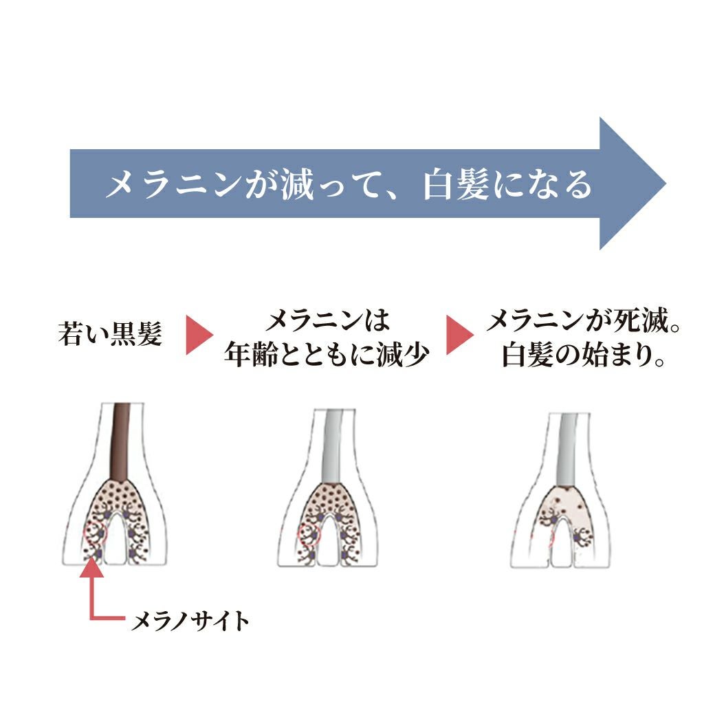 アンチグレイローション 頭皮用エイジングケア 白髪ケア | エルゴン
